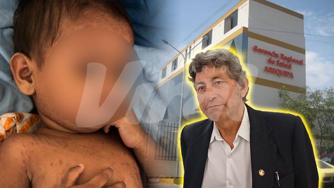 Arequipa: bebé de 11 meses es el tercer caso importado de sarampión